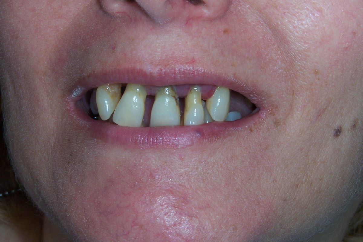 Gallery Country Club Dental Care